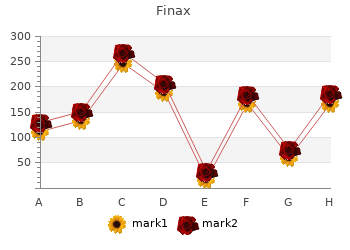 order 1mg finax with visa