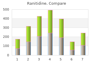 generic ranitidine 150mg otc