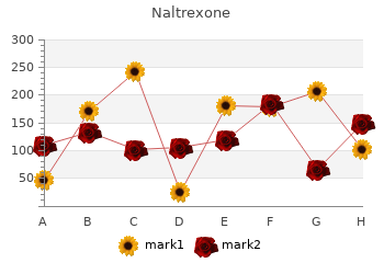 discount 50 mg naltrexone with mastercard