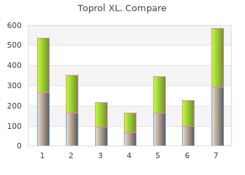 buy toprol xl 25 mg free shipping