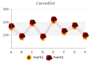 discount carvedilol 6.25 mg without a prescription