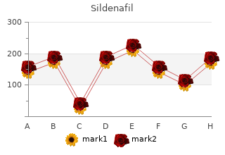 order 75mg sildenafil visa